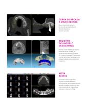 BTI Scan® 4 - Software de Planificación para Implantología Oral - 4