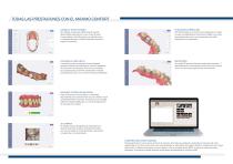 3D DIGITAL IMPRESSION INTRA ORAL SCANNER - 5