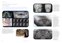 X-Radius COMPACT | Castellini-8