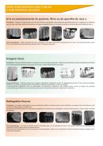 Radiografias dentárias - 2