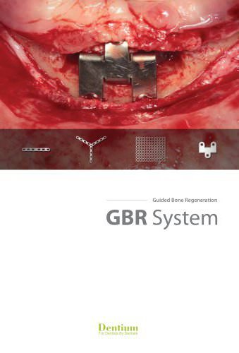 GBR system GSPS-1304