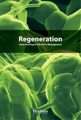 Regeneration Bone Grafting & Soft Tissue Management