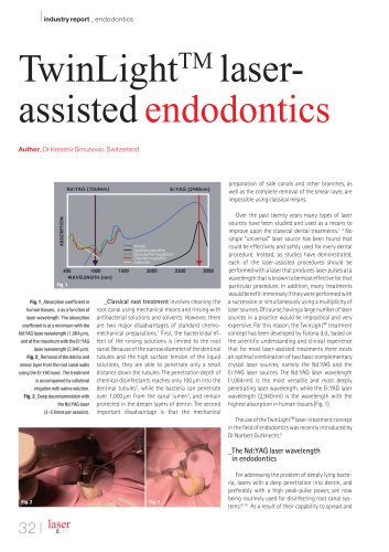 TwinLight? Laser Assisted Endodontics