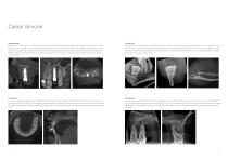 Veraviewepocs 3D R100 - 7