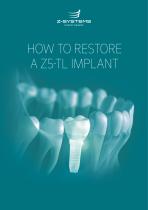 HOW TO RESTORE A Z5-TL IMPLANT