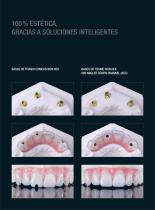 Bases en titanio K80 Angeled Screw Channel - 3