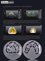 Galería de cas Implant-Planner Workflow - 2