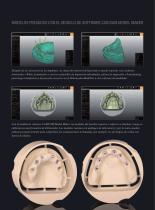 Galería de cas Implant-Planner Workflow - 3