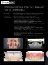 Galeria de casos Florence Zircoprox® Denture System-2