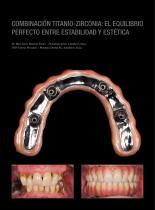 Galeria de casos Prettau® 2 Dispersive®-3