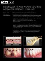 Galeria de casos Prettau® 3 Dispersive® - 2