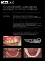 Galeria de casos Prettau® 3 Dispersive®-2