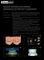 Galeria de casos Prettau® 3 Dispersive®-2