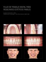 Galeria de casos Prettau® 3 Dispersive®-3