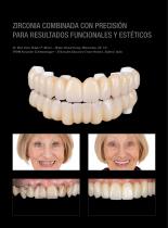 Galeria de casos Prettau® 3 Dispersive® sobre ICE Plus-3
