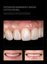 Galeria de casos Prettau® Skin®-3