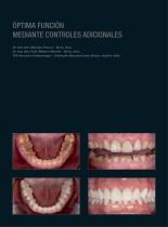 Galería de casos Prime Multistratum® - 3