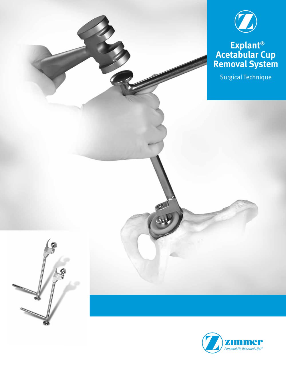 Explant Acetabular Cup Removal System Surgical Technique - Zimmer Biomet