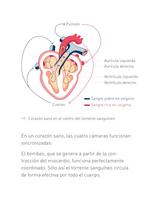 Congestive Heart Failure Therapy System - 6