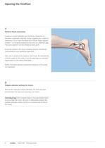 Expert Hindfoot Arthrodesis Nail - 10