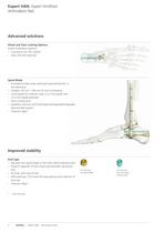 Expert Hindfoot Arthrodesis Nail - 4