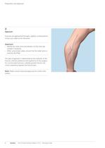 VA-LCP Elbow - 10