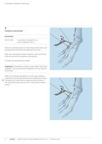 Variable Angle LCP Forefoot/Midfoot System 2.4/2.7-10