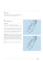Variable Angle LCP Forefoot/Midfoot System 2.4/2.7-9