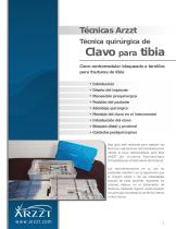 Clavo Intramedular para Tibia - 2