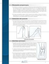 Clavo Intramedular para Tibia - 4