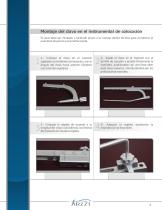 Clavo Intramedular para Tibia - 5