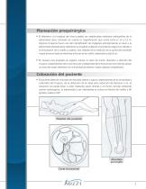 Técnica quirúrgica de Clavo para femur - 4