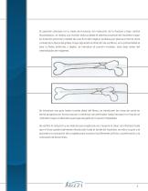 Técnica quirúrgica de Clavo para femur - 6