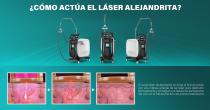 Perfectlaser Z110Pro Máquina de depilación láser de pulso largo Alejandrita-15