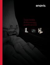 Total Ankle Arthroscopy and Fracture